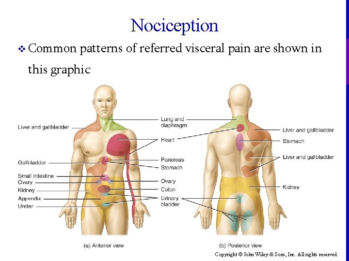 Nociception v Common patterns of referred visceral pain are shown in this graphic Copyright