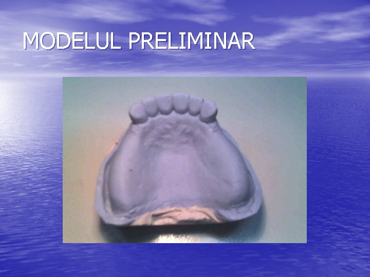 MODELUL PRELIMINAR 