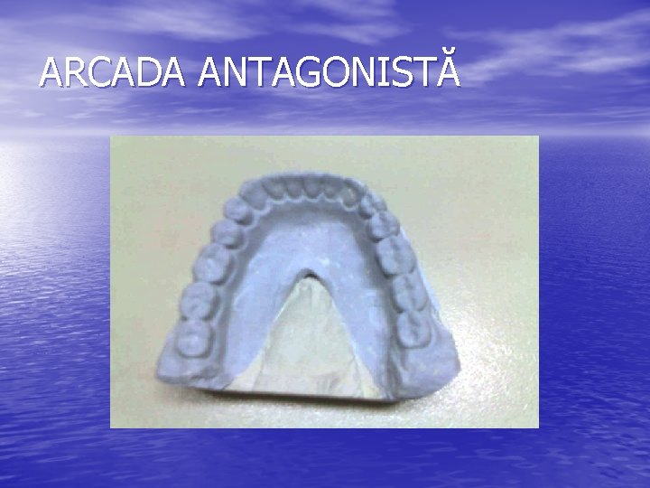 ARCADA ANTAGONISTĂ 
