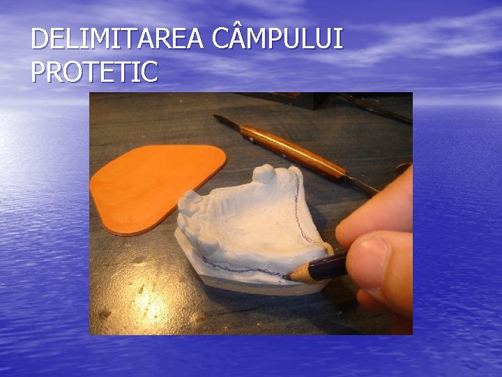 DELIMITAREA C MPULUI PROTETIC 