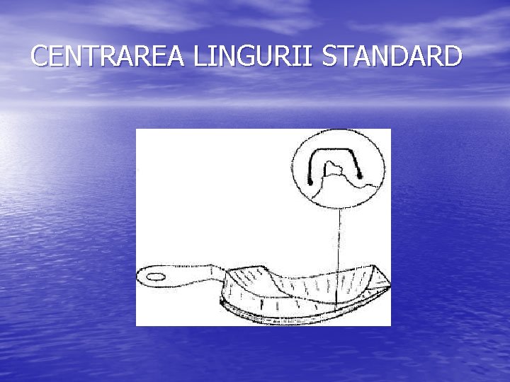 CENTRAREA LINGURII STANDARD 