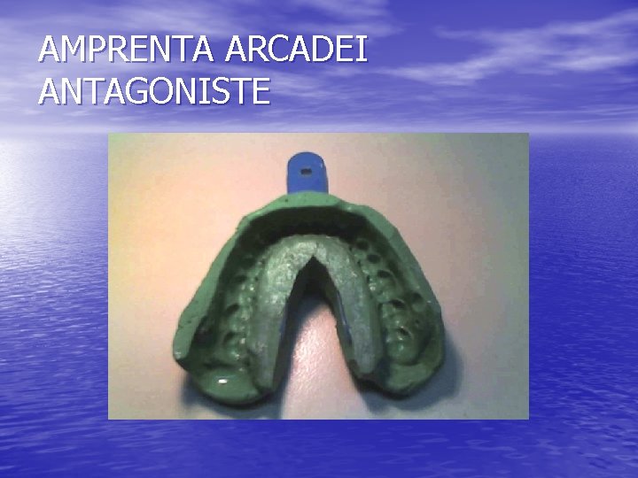 AMPRENTA ARCADEI ANTAGONISTE 