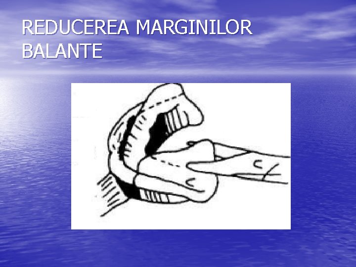 REDUCEREA MARGINILOR BALANTE 