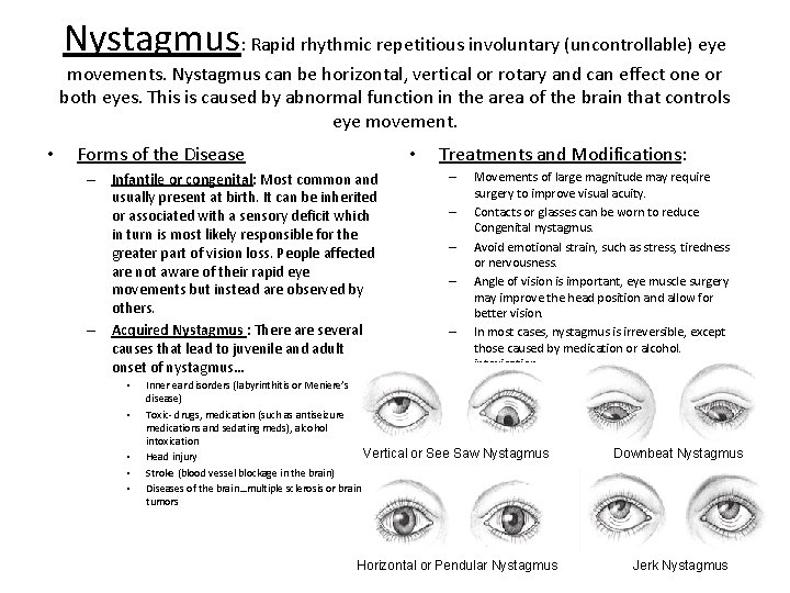 Nystagmus: Rapid rhythmic repetitious involuntary (uncontrollable) eye movements. Nystagmus can be horizontal, vertical or