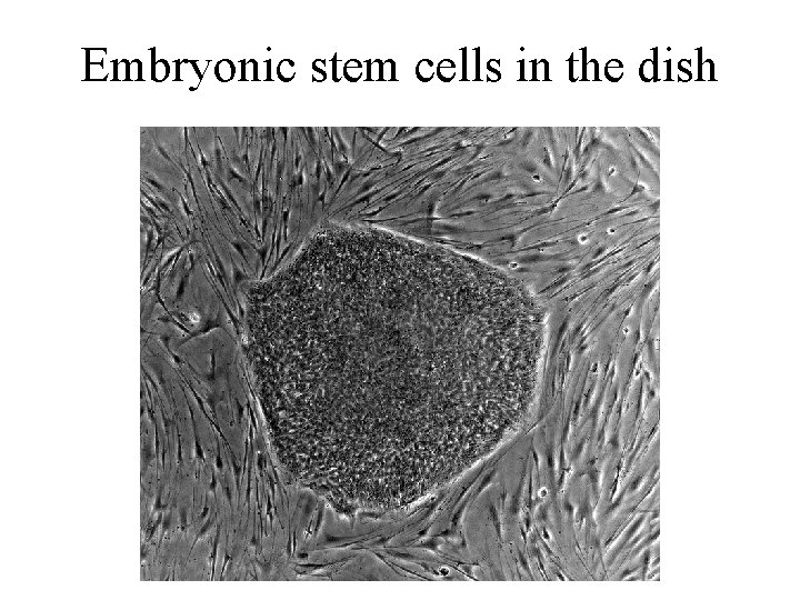 Embryonic stem cells in the dish 