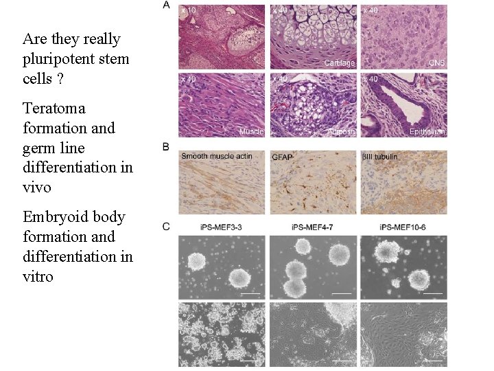 Are they really pluripotent stem cells ? Teratoma formation and germ line differentiation in