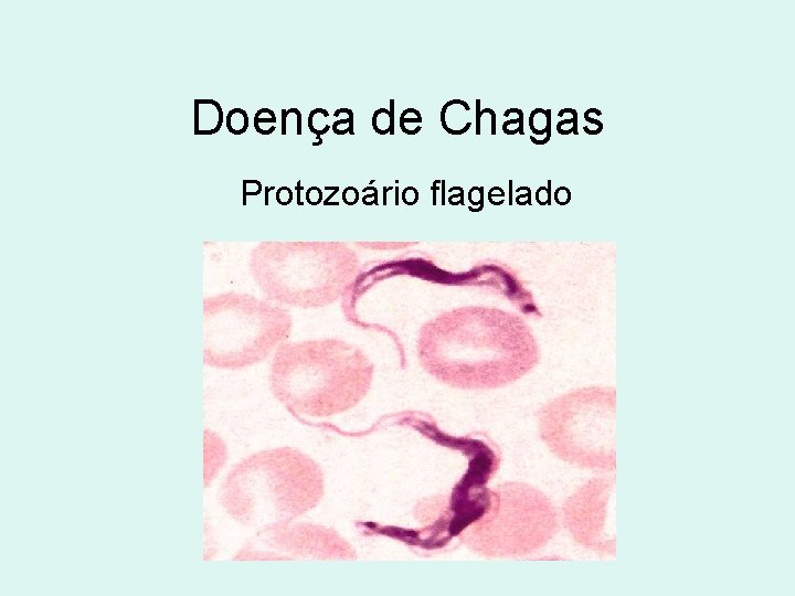 Doença de Chagas Protozoário flagelado 