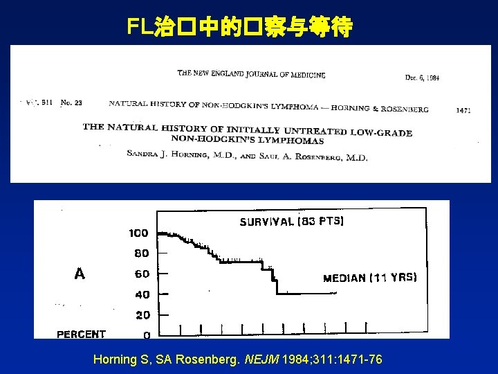 FL治�中的�察与等待 MJR Horning S, SA Rosenberg. NEJM 1984; 311: 1471 -76 