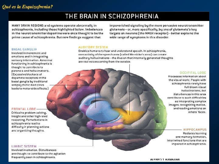 Qué es la Esquizofrenia? 