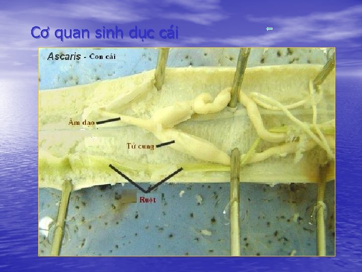 Cơ quan sinh dục cái 