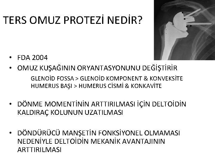 TERS OMUZ PROTEZİ NEDİR? • FDA 2004 • OMUZ KUŞAĞININ ORYANTASYONUNU DEĞİŞTİRİR GLENOİD FOSSA