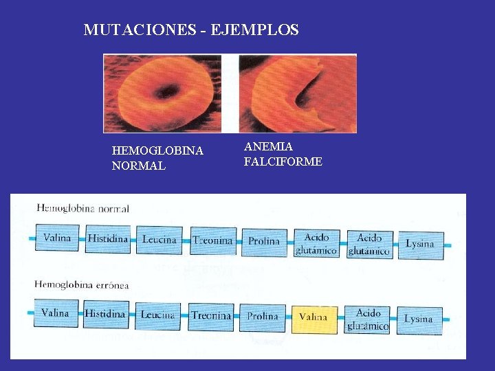 MUTACIONES - EJEMPLOS HEMOGLOBINA NORMAL ANEMIA FALCIFORME 