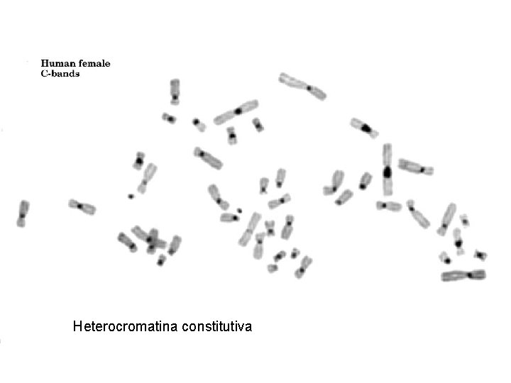 Heterocromatina constitutiva 