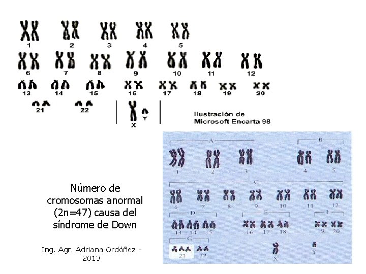 Número de cromosomas anormal (2 n=47) causa del síndrome de Down Ing. Agr. Adriana