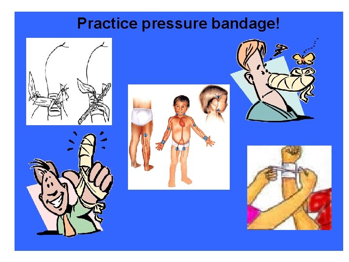 Practice pressure bandage! 