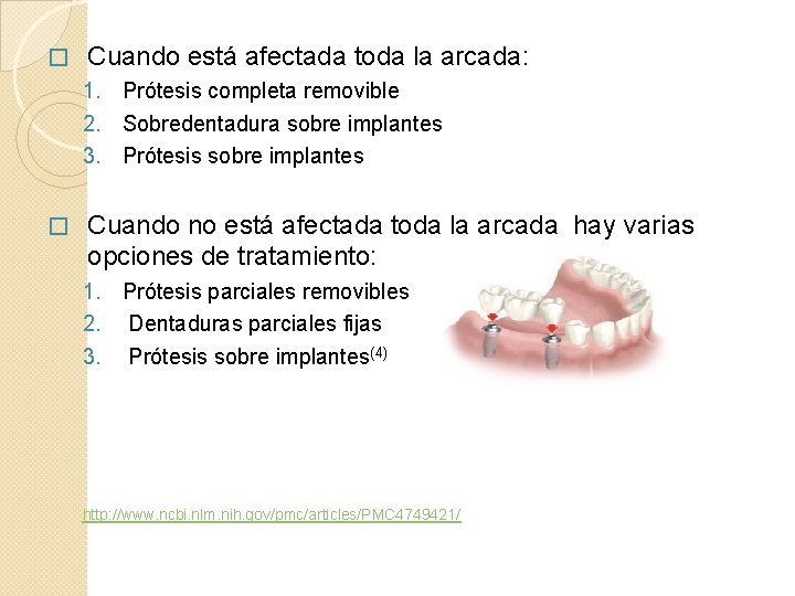  � Cuando está afectada toda la arcada: 1. Prótesis completa removible 2. Sobredentadura