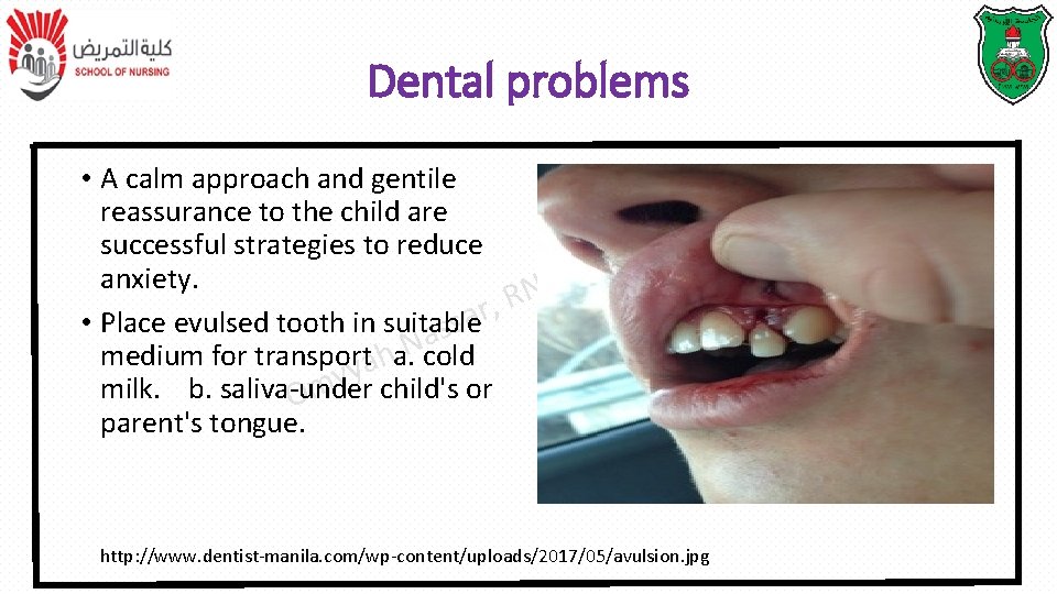 Dental problems • A calm approach and gentile reassurance to the child are T Dental problems • A calm approach and gentile reassurance to the child are T