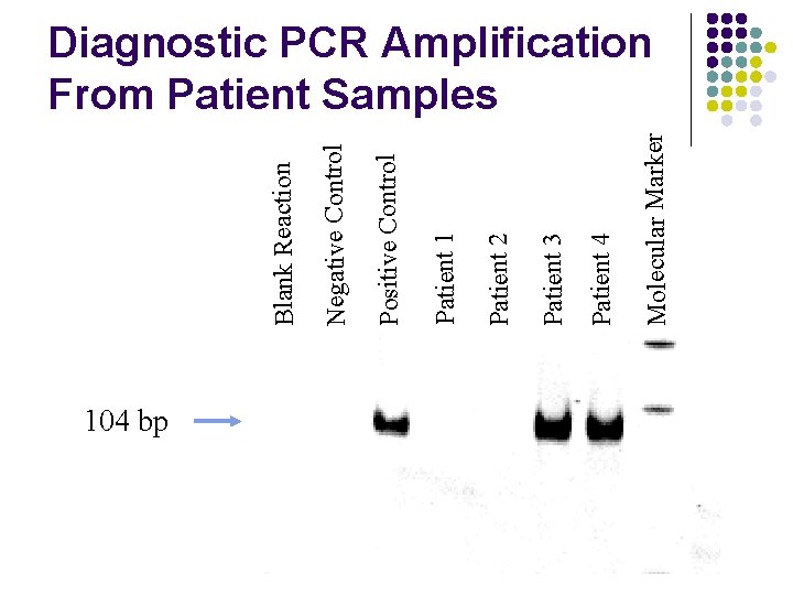 104 bp Molecular Marker Patient 4 Patient 3 Patient 2 Patient 1 Positive Control 104 bp Molecular Marker Patient 4 Patient 3 Patient 2 Patient 1 Positive Control