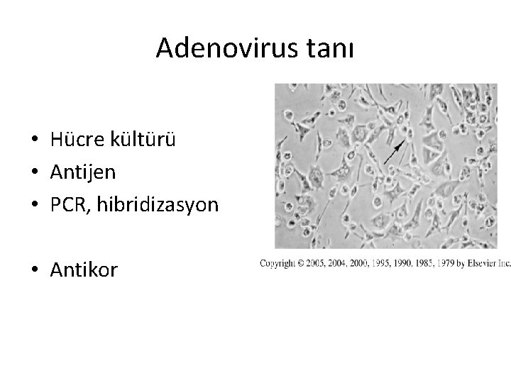 Adenovirus tanı • Hücre kültürü • Antijen • PCR, hibridizasyon • Antikor 