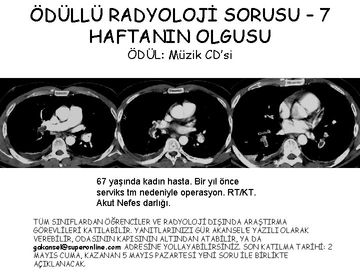 ÖDÜLLÜ RADYOLOJİ SORUSU – 7 HAFTANIN OLGUSU ÖDÜL: Müzik CD’si 67 yaşında kadın hasta.