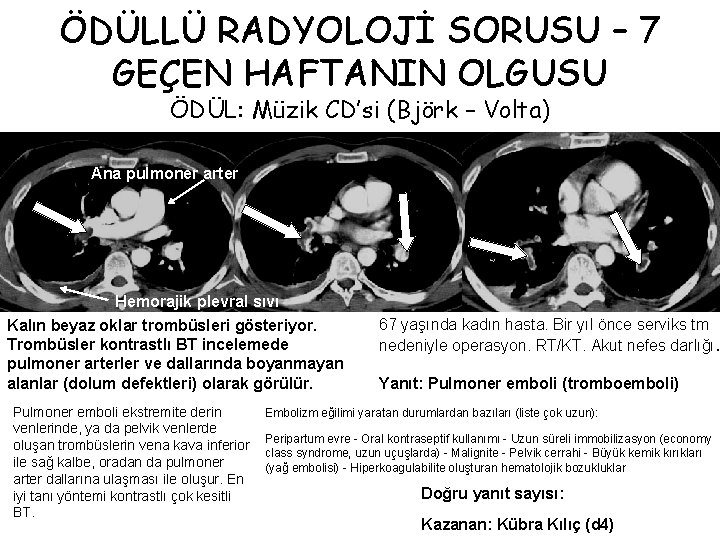 ÖDÜLLÜ RADYOLOJİ SORUSU – 7 GEÇEN HAFTANIN OLGUSU ÖDÜL: Müzik CD’si (Björk – Volta)