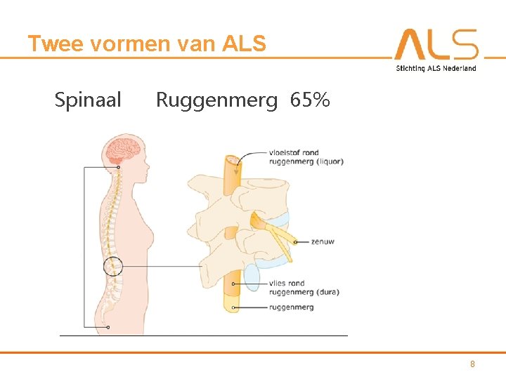 Twee vormen van ALS Spinaal Ruggenmerg 65% 8 