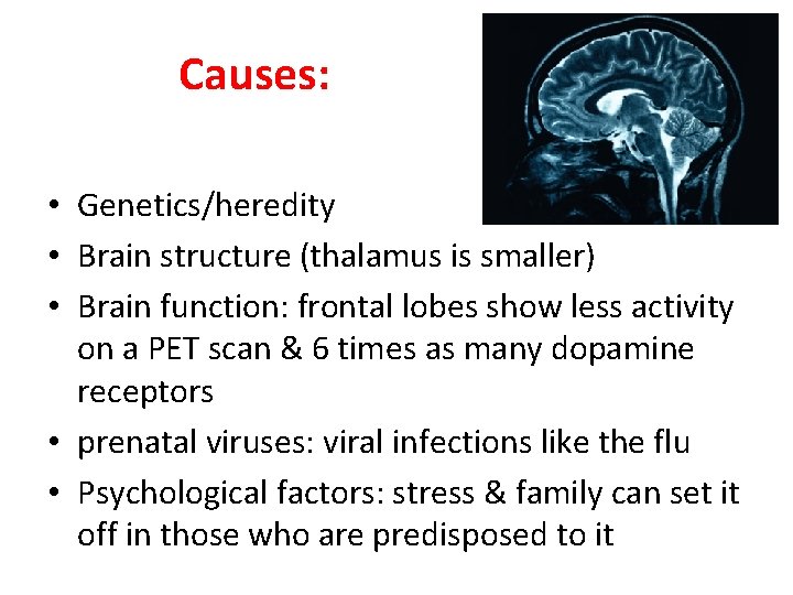 Causes: • Genetics/heredity • Brain structure (thalamus is smaller) • Brain function: frontal lobes