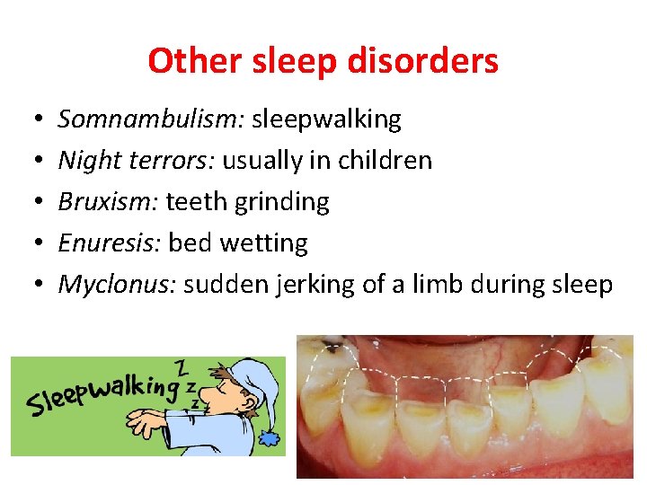 Other sleep disorders • • • Somnambulism: sleepwalking Night terrors: usually in children Bruxism: