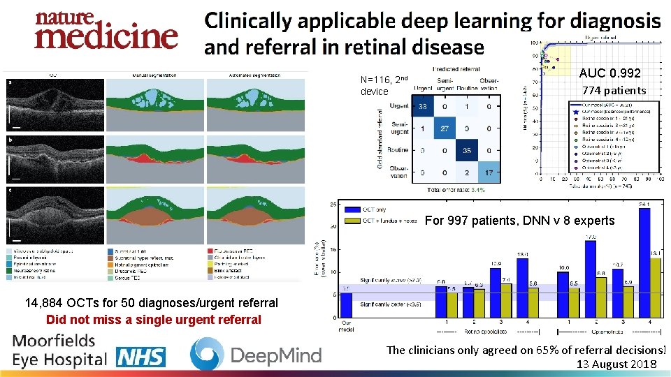 N=116, 2 nd device AUC 0. 992 774 patients For 997 patients, DNN v