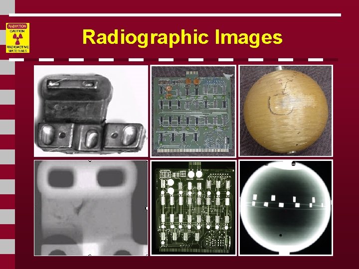 Radiographic Images 