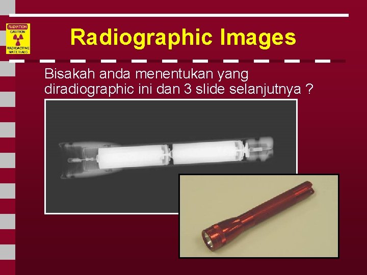 Radiographic Images Bisakah anda menentukan yang diradiographic ini dan 3 slide selanjutnya ? 