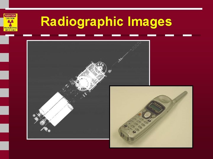 Radiographic Images 