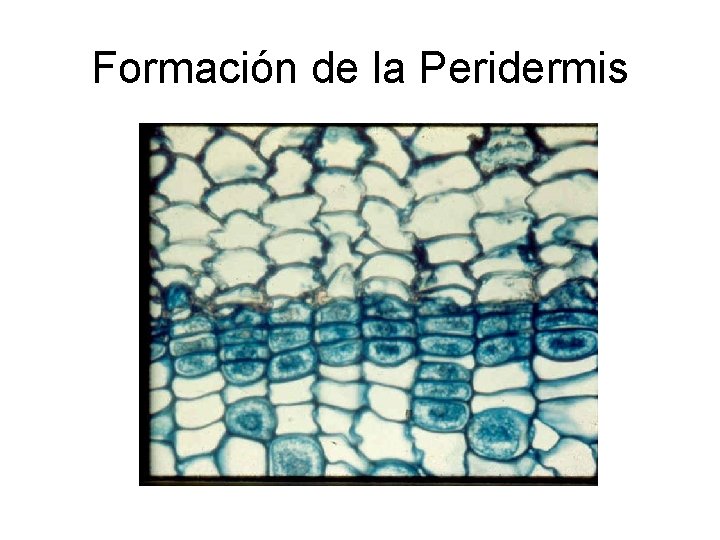 Formación de la Peridermis 