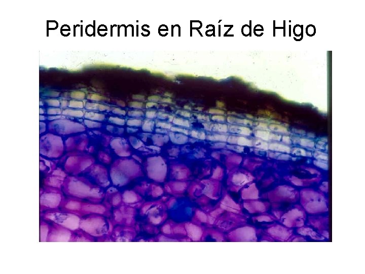 Peridermis en Raíz de Higo 