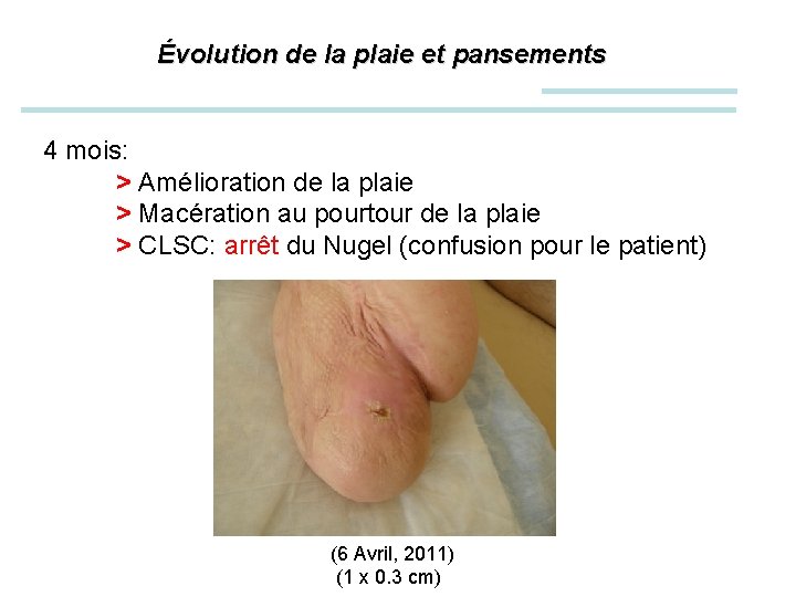 Évolution de la plaie et pansements 4 mois: > Amélioration de la plaie >