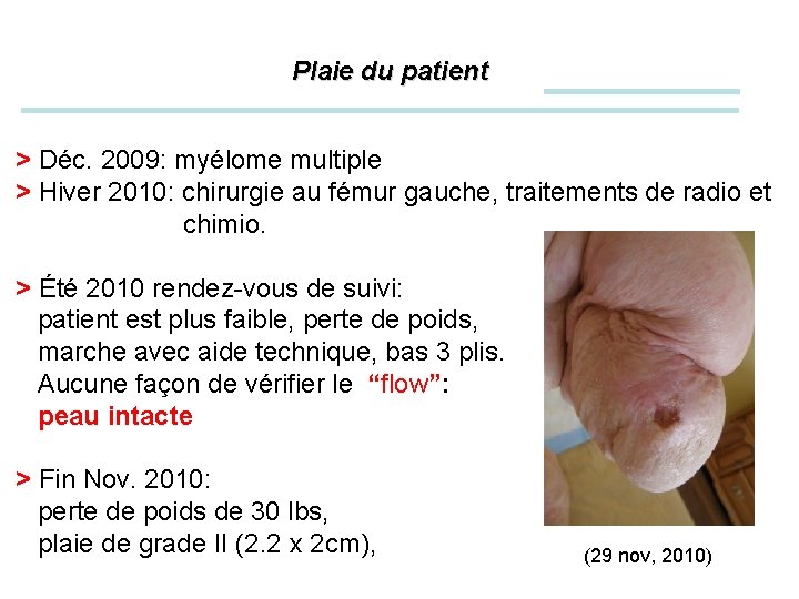 Plaie du patient > Déc. 2009: myélome multiple > Hiver 2010: chirurgie au fémur