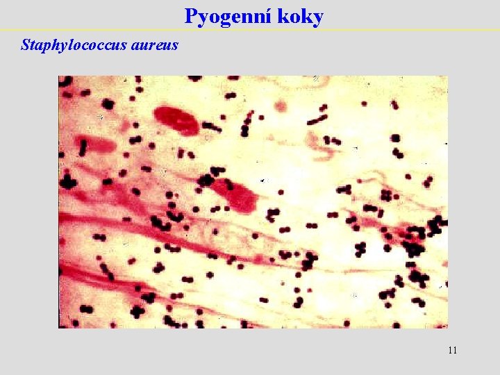 Pyogenní koky Staphylococcus aureus 11 