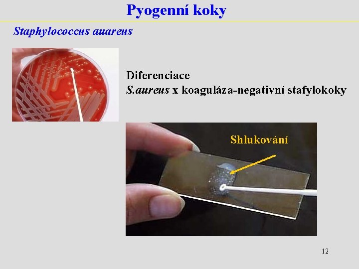 Pyogenní koky Staphylococcus auareus Diferenciace S. aureus x koaguláza-negativní stafylokoky Shlukování 12 