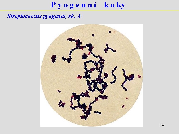 Pyogenní k o ky Streptococcus pyogenes, sk. A 14 