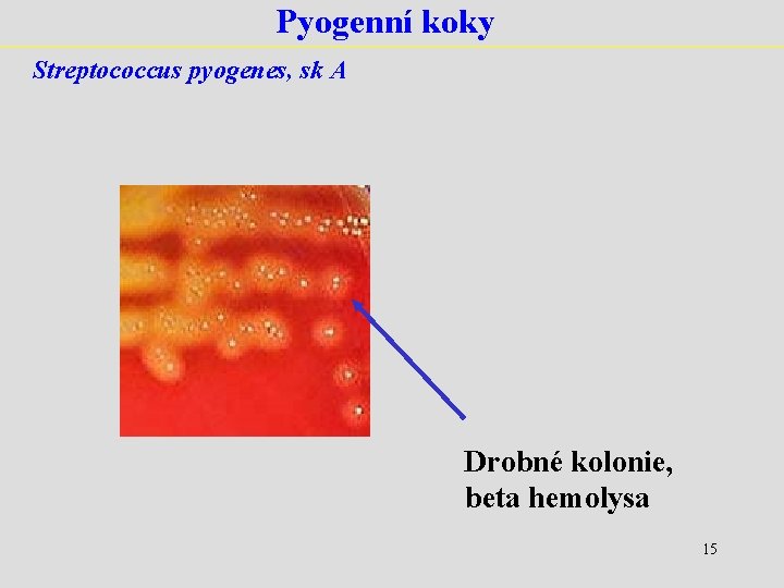 Pyogenní koky Streptococcus pyogenes, sk A Drobné kolonie, beta hemolysa 15 