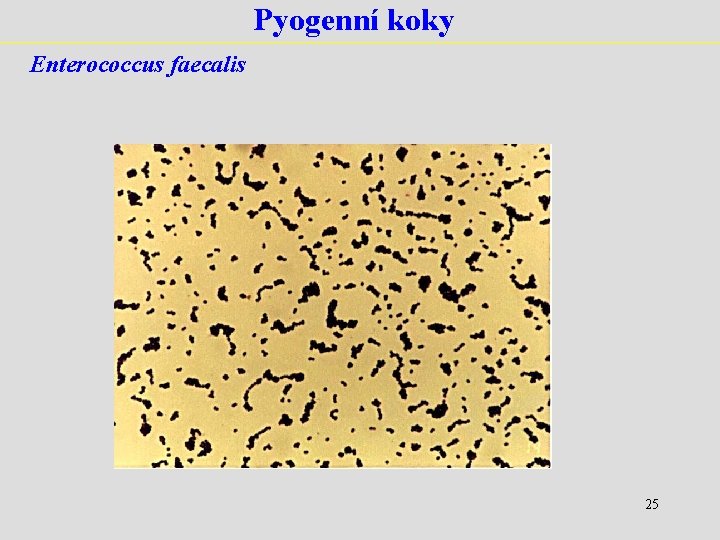 Pyogenní koky Enterococcus faecalis 25 