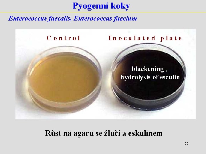 Pyogenní koky Enterococcus faecalis, Enterococcus faecium Control Inoculated plate blackening , hydrolysis of esculin