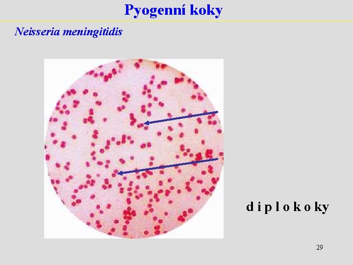 Pyogenní koky Neisseria meningitidis d i p l o ky 29 