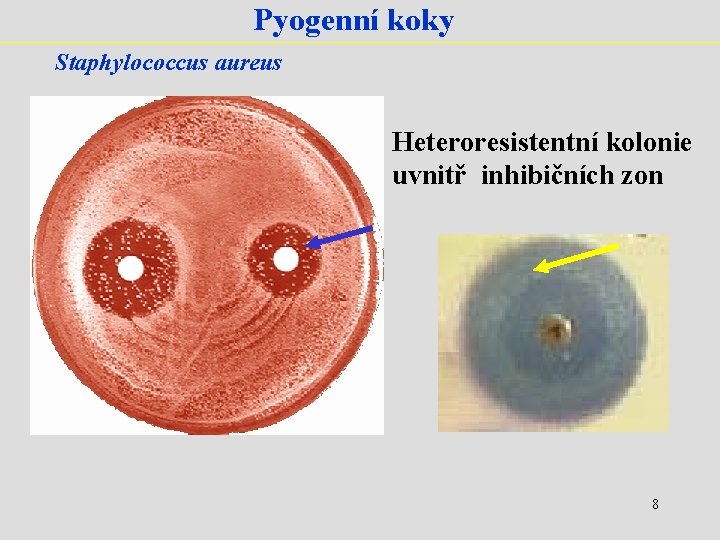 Pyogenní koky Staphylococcus aureus Heteroresistentní kolonie uvnitř inhibičních zon 8 