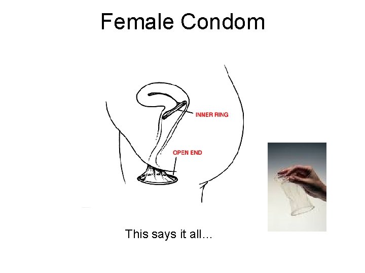 Female Condom This says it all… 
