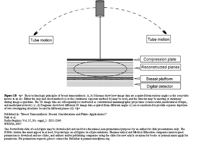 Figure 1 B <p> Basic technologic principles of breast tomosynthesis. (a, b) Schemas show