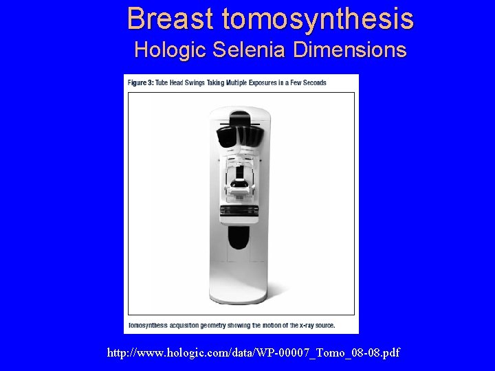 Breast tomosynthesis Hologic Selenia Dimensions http: //www. hologic. com/data/WP-00007_Tomo_08 -08. pdf 