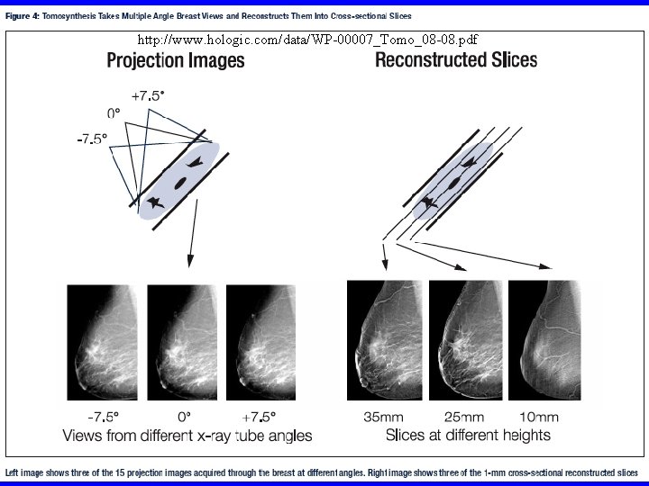 http: //www. hologic. com/data/WP-00007_Tomo_08 -08. pdf Cone Beam Breast CT University of Rochester 300