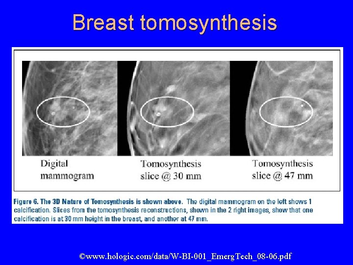 Breast tomosynthesis ©www. hologic. com/data/W-BI-001_Emerg. Tech_08 -06. pdf 