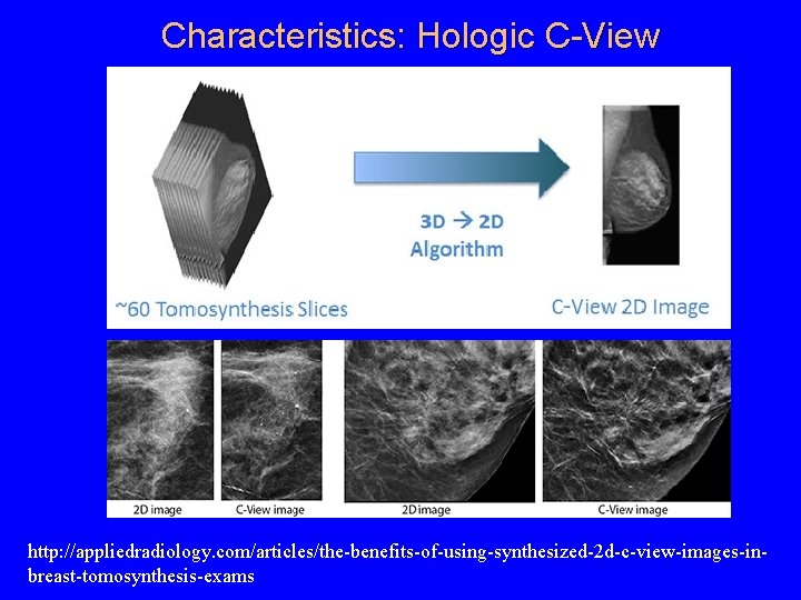 Characteristics: Hologic C-View http: //appliedradiology. com/articles/the-benefits-of-using-synthesized-2 d-c-view-images-inbreast-tomosynthesis-exams 